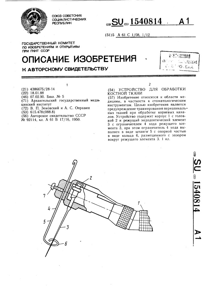 Устройство для обработки костной ткани (патент 1540814)