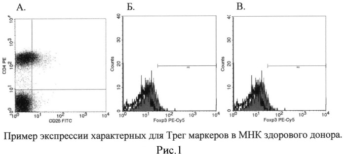 Способ терапии ремиттирующего рассеянного склероза (патент 2523058)