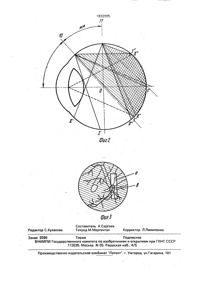 Устройство для исследования глазного дна (патент 1832005)