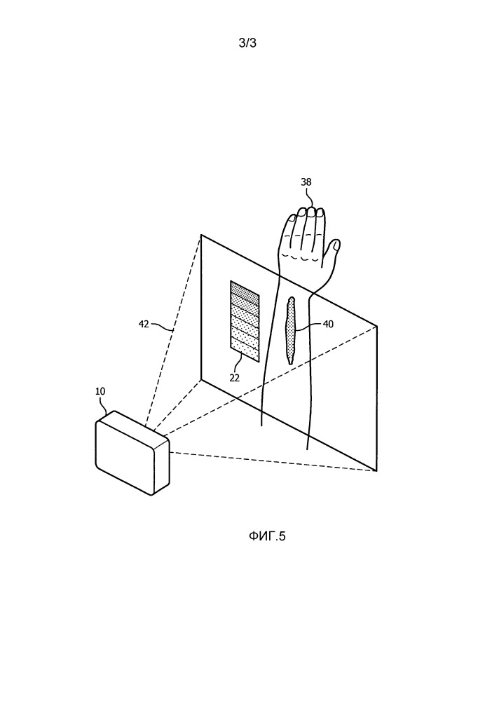 Медицинское устройство или система для измерения уровней гемоглобина во время несчастных случаев, используя систему камера-проектор (патент 2652060)