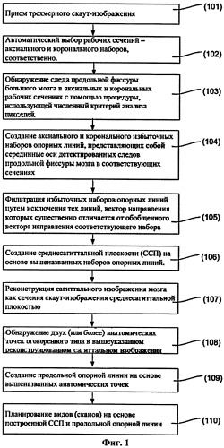 Система и способ для автоматического планирования видов в объемных изображениях мозга (патент 2523929)