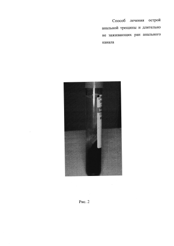 Способ лечения острой анальной трещины и длительно незаживающих ран анального канала (патент 2578853)