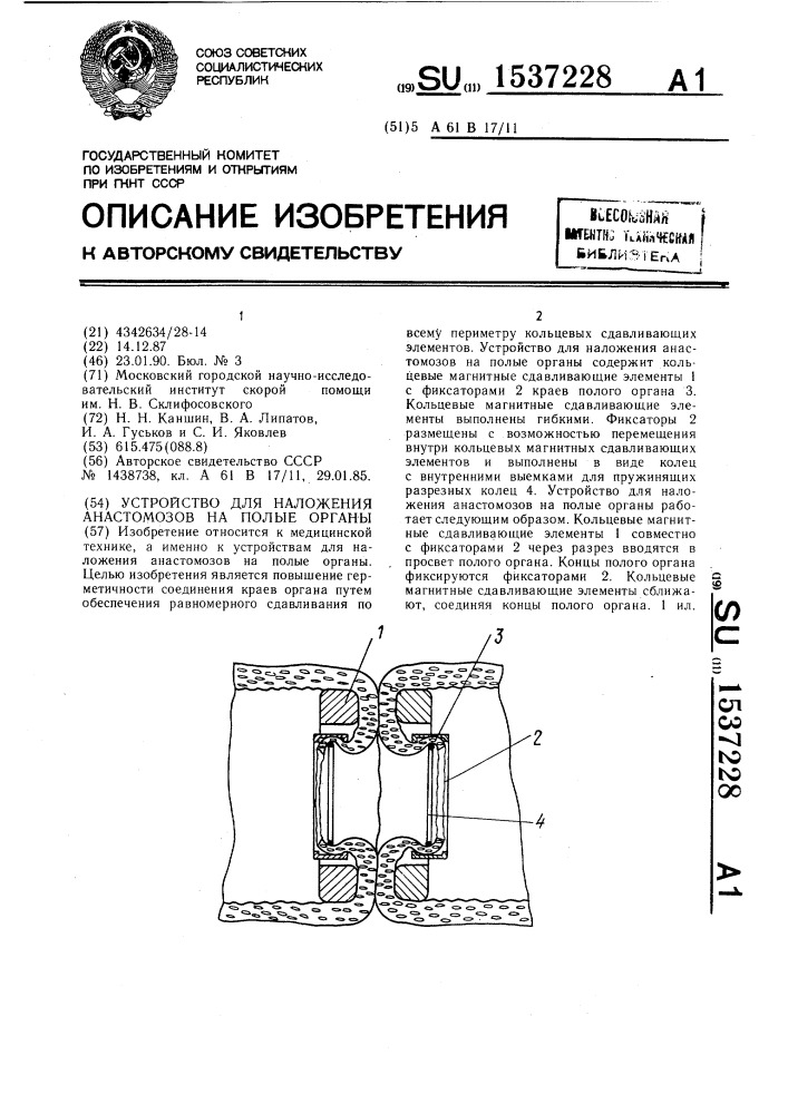 Устройство для наложения анастомозов на полые органы (патент 1537228)