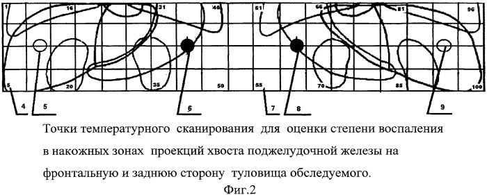 Способ исследования температурного режима поджелудочной железы при диагностике сахарного диабета 1-го типа (патент 2514529)