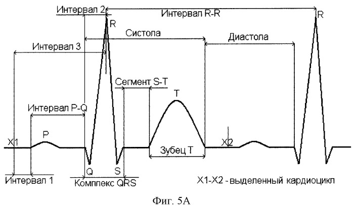 Способ выделения начала кардиоцикла и устройство для его осуществления (патент 2294139)