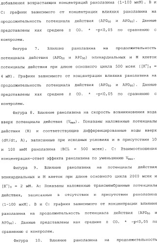 Применение ранолазина для изготовления лекарственного средства для лечения аритмий (патент 2325161)
