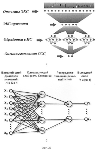 Способ обработки электрокардиосигнала для диагностики инфаркта миокарда (патент 2383295)