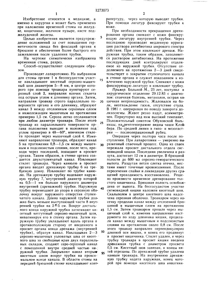 Способ формирования временной стомы полого органа (патент 1273073)