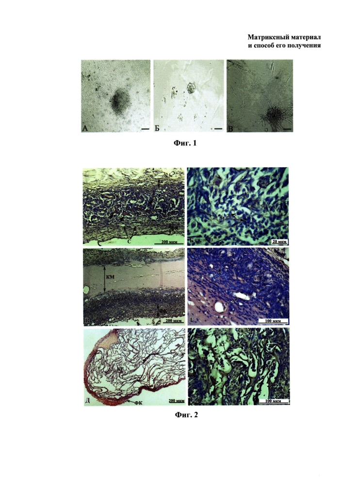 Имплантируемый матриксный материал для регенеративной медицины и способ его получения (варианты) (патент 2597085)