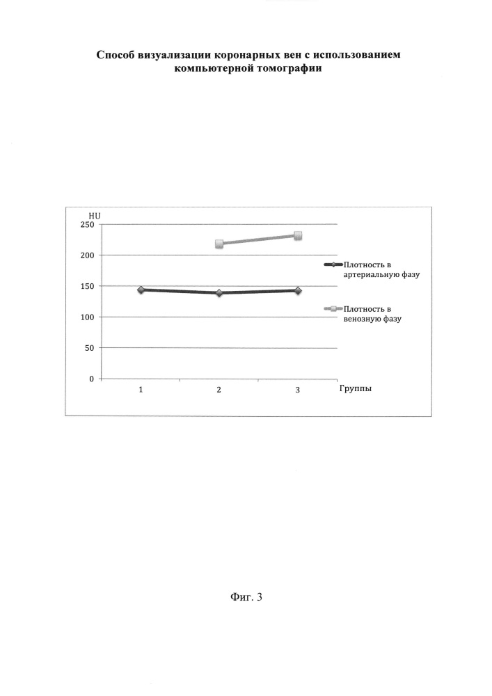 Способ визуализации коронарных вен с использованием компьютерной томографии (патент 2648851)