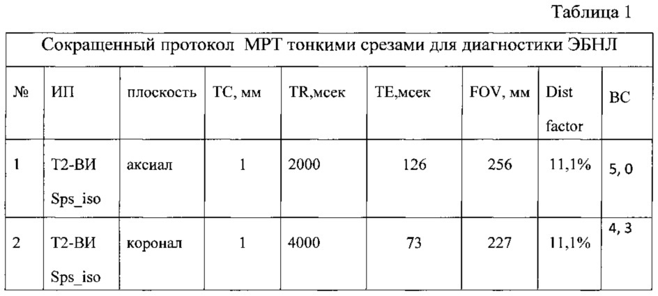 Способ диагностики эктопической беременности (патент 2638290)