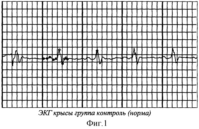 Коронароактивное антиишемическое и антиаритмическое средство (патент 2290927)