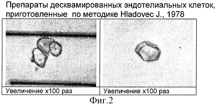 Способ приготовления препаратов десквамированных эндотелиальных клеток периферической крови (патент 2309752)