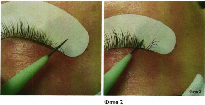 Способ наращивания ресниц "lash-to-lash" (патент 2541953)