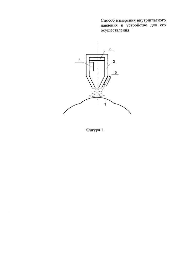 Способ измерения внутриглазного давления и устройство для его осуществления (патент 2665112)