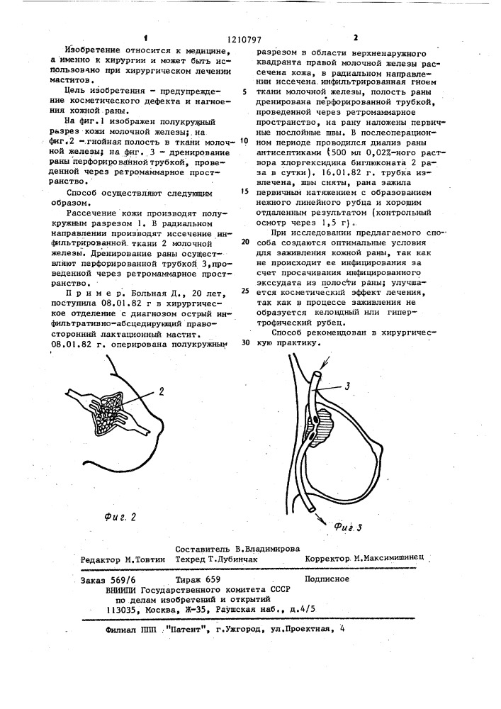 Способ лечения гнойно-инфильтративных интрамаммарных маститов (патент 1210797)