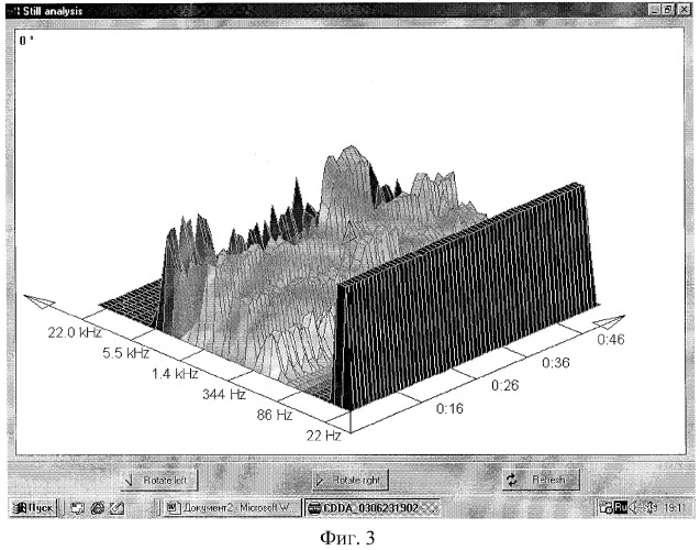 Способ контроля состояния криосистемы охлаждения экрана магнитно-резонансных томографов (патент 2290863)
