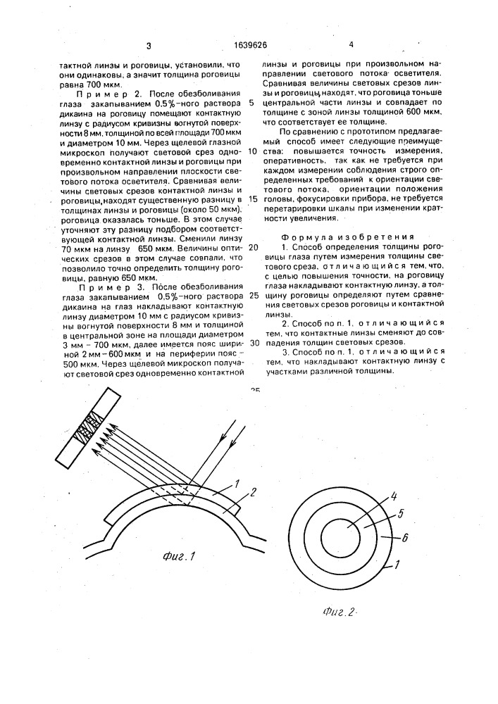 Способ определения толщины роговицы глаза (патент 1639626)