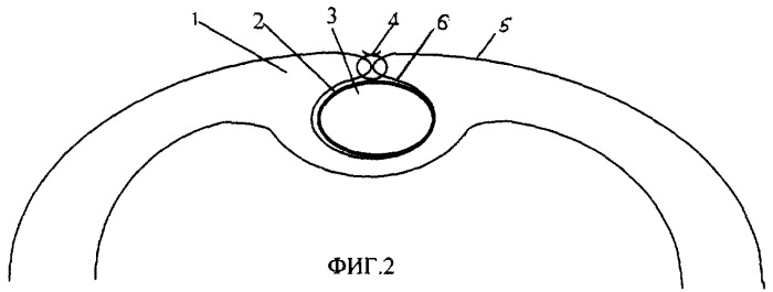 Способ мониторинга отека биологической ткани (патент 2253360)