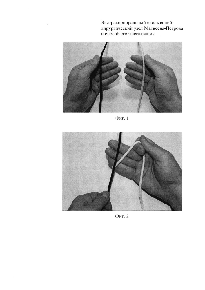 Экстракорпоральный скользящий хирургический узел матвеева-петрова и способ его завязывания (патент 2619751)