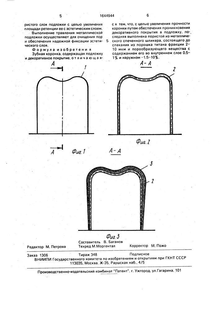 Зубная коронка (патент 1644944)