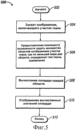 Система и способ слежения за процессом заживания ткани (патент 2430680)