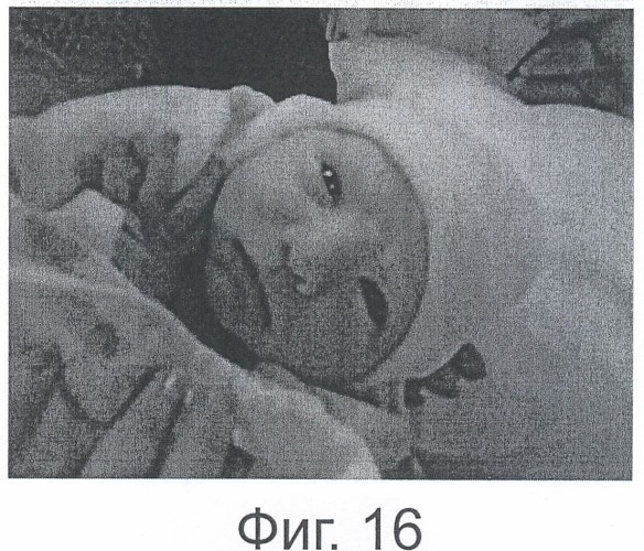 Способ и устройство для уменьшения шумов в видеоизображении (патент 2486591)