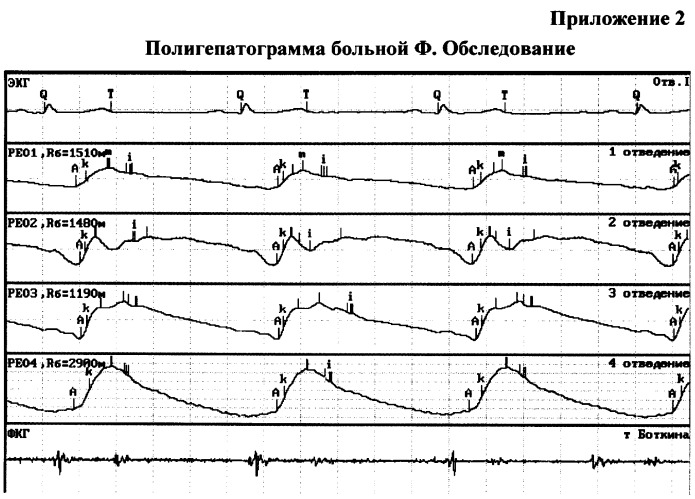 Способ и устройство для оценки гемодинамики печени (патент 2372022)