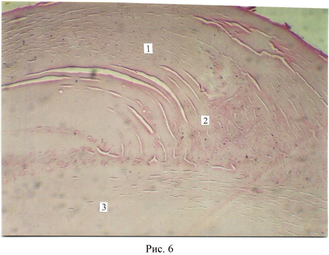 Способ экспериментального моделирования коркового вида катаракты in vivo (патент 2553577)