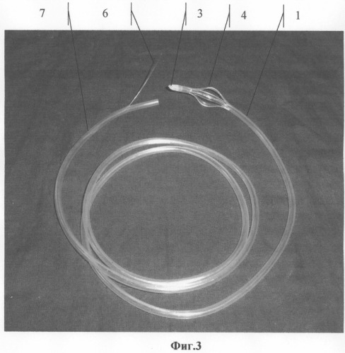 Неприсасывающийся назогастральный зонд (патент 2243787)