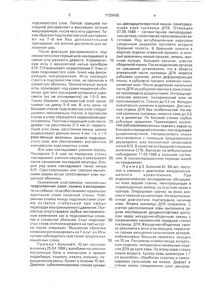 Способ кишечного шва (патент 1729495)