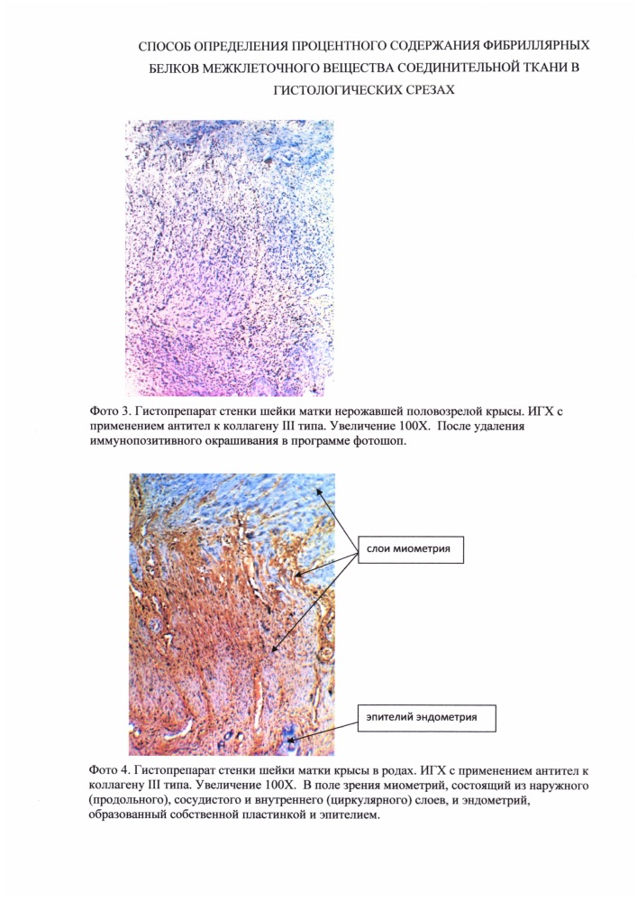 Способ анализа структур межклеточного вещества соединительной ткани в гистологических срезах шейки матки у животных (патент 2646469)