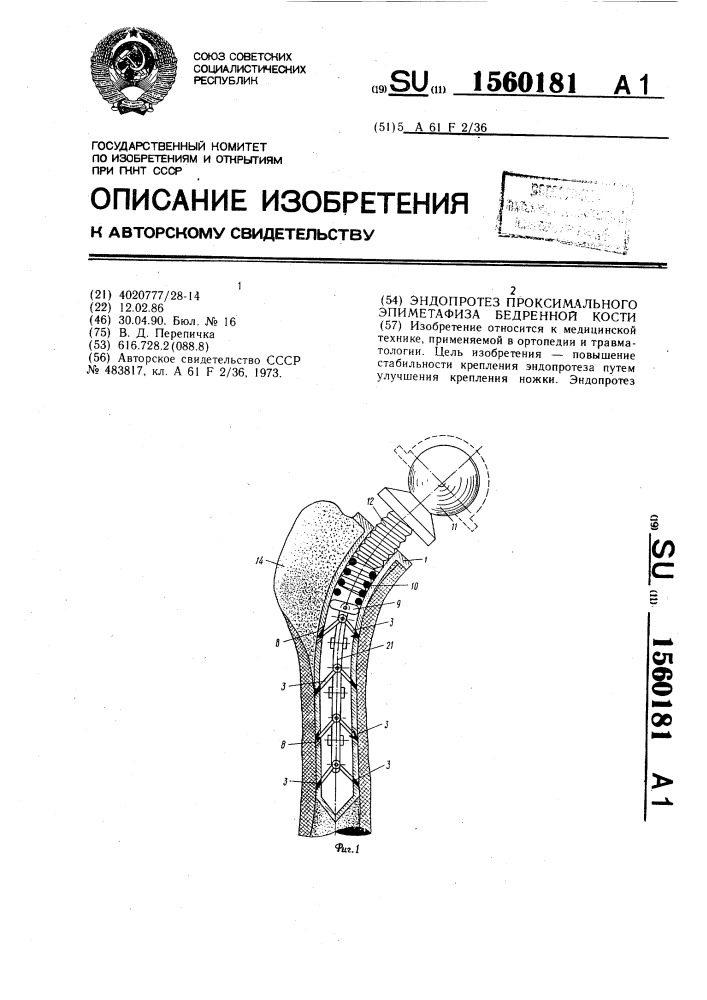 Эндопротез проксимального эпиметафиза бедренной кости (патент 1560181)