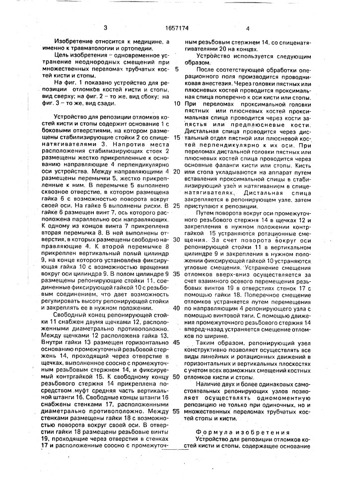 Устройство для репозиции отломков костей кисти и стопы (патент 1657174)