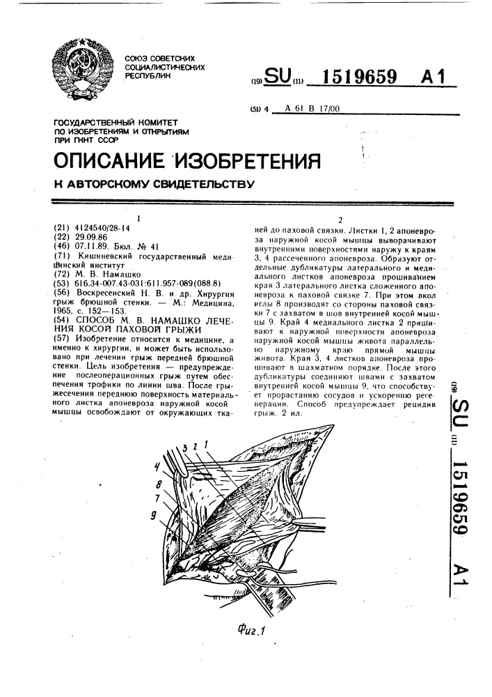 Способ м.в.намашко лечения косой паховой грыжи (патент 1519659)