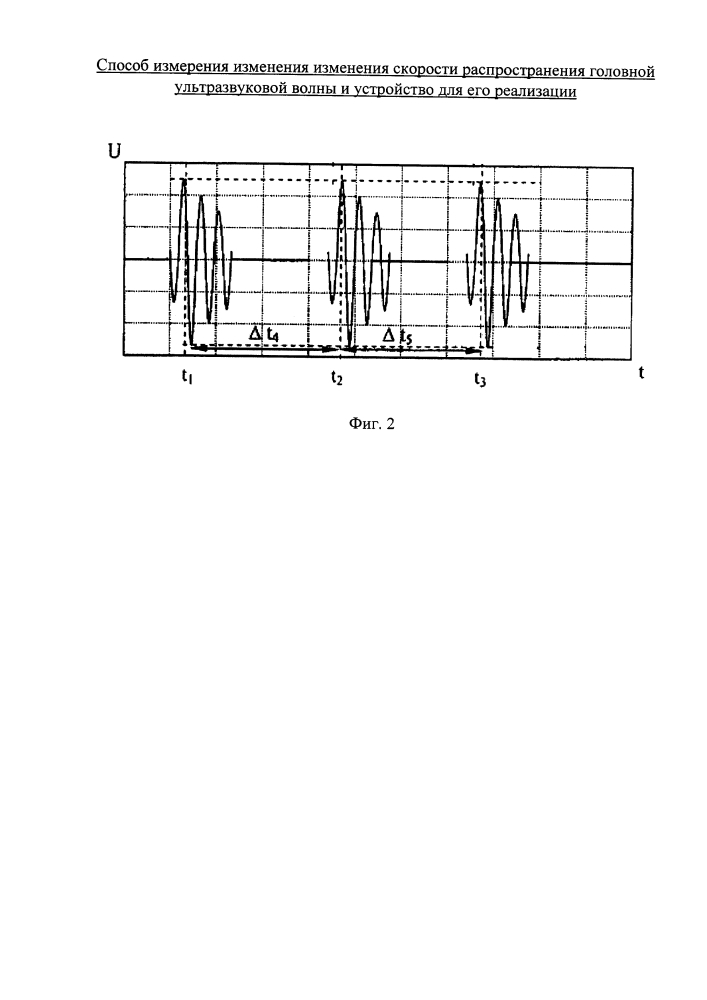 Способ измерения изменения скорости распространения головной ультразвуковой волны и устройство для его реализации (патент 2643232)