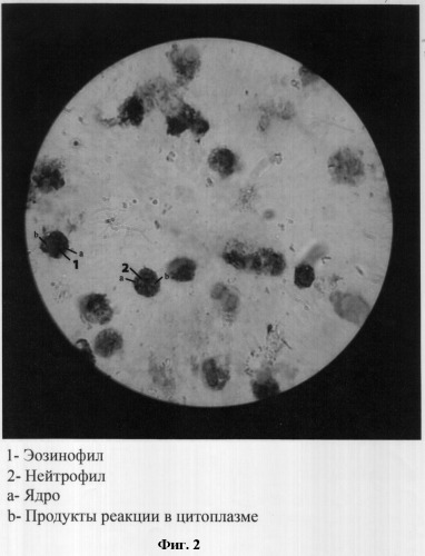 Способ определения продуктов цитохимической реакции, протекающей в нейтрофилах и эозинофилах мокроты под воздействием миелопероксидазы (патент 2298184)