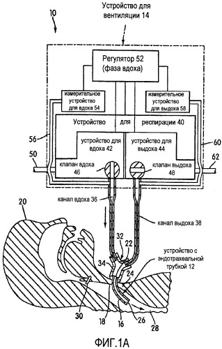 Аппарат для вентиляции и способ, позволяющий пациенту говорить с обратным клапаном трахеостомической трубки или без него (патент 2455031)
