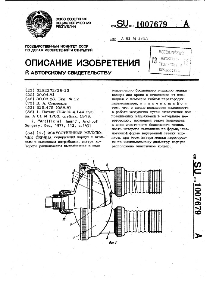 Искусственный желудочек сердца (патент 1007679)