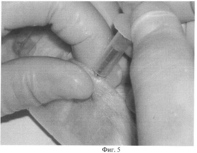 Устройство для малотравматичной перфорационной биопсии кожи человека и лабораторных животных (патент 2468756)