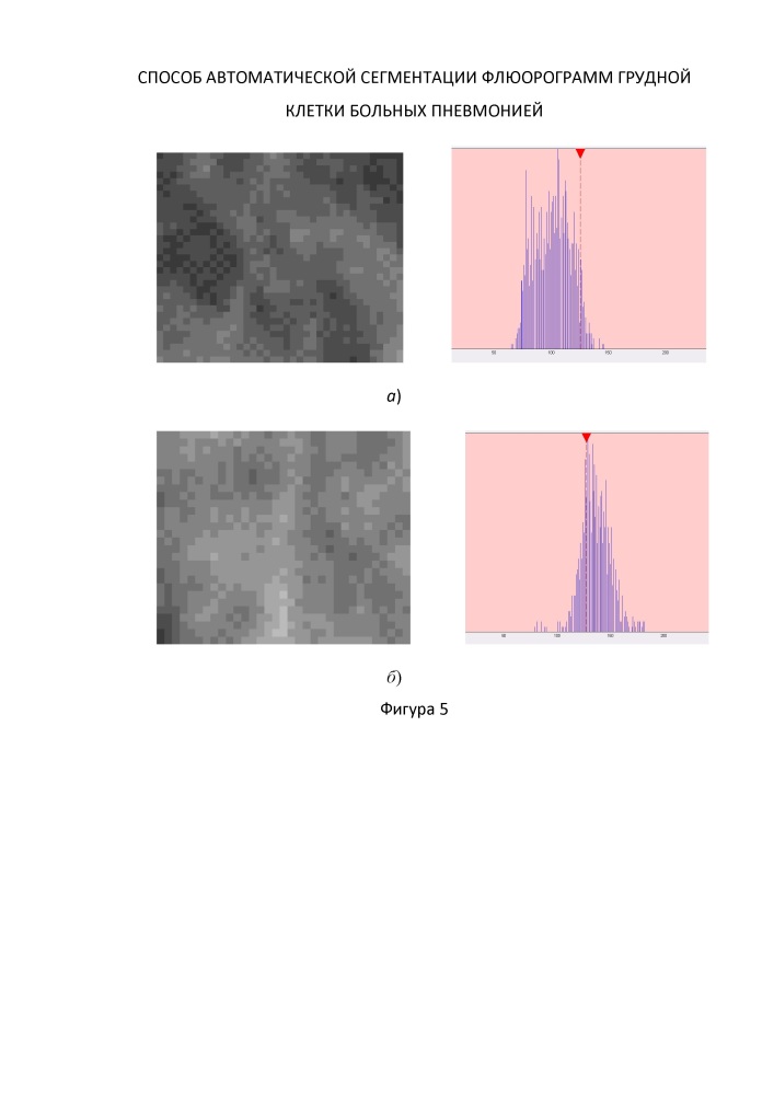 Способ автоматической сегментации флюорограмм грудной клетки больных пневмонией (патент 2629629)