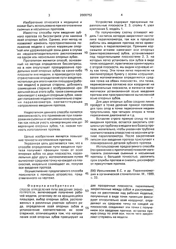 Способ определения пути введения зубного протеза (патент 2000752)