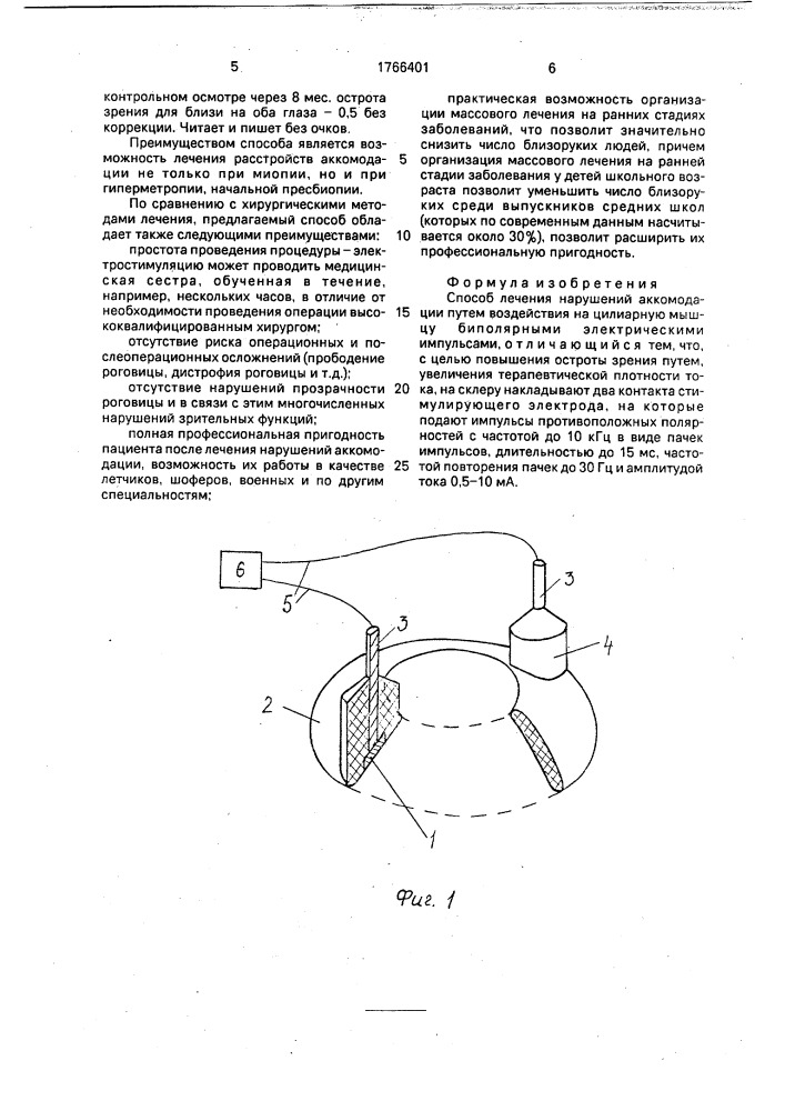 Способ лечения нарушений аккомодации (патент 1766401)
