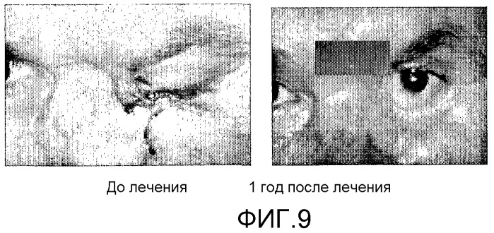 Стабильные фармацевтические составы, которые содержат интерфероны гамма и альфа в синергичных соотношениях (патент 2403057)