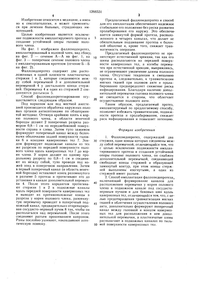 Фаллоэндопротез и способ его имплантации (патент 1266531)
