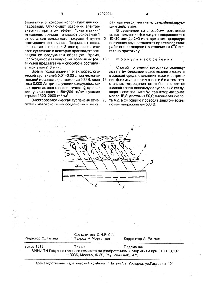 Способ получения волосяных фолликулов (патент 1732995)