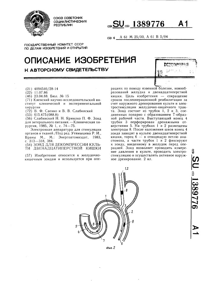 Зонд для декомпрессии культи двенадцатиперстной кишки (патент 1389776)