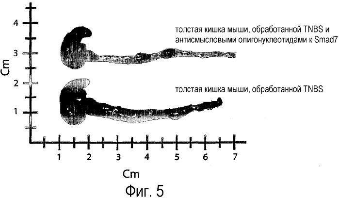 Антисмысловые олигонуклеотиды (odn) к smad7 и их применение в области медицины (патент 2339697)