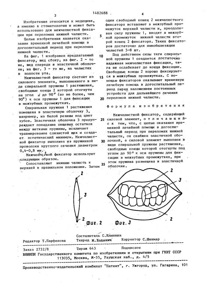 Межчелюстной фиксатор (патент 1482688)