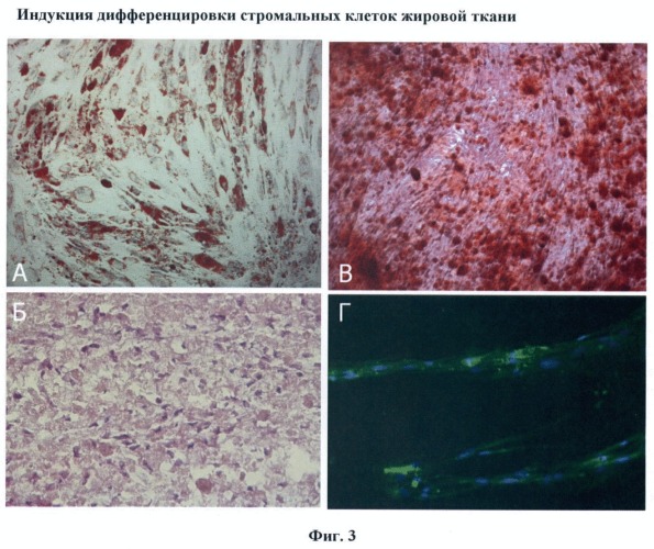 Среда культивирования мультипотентных стромальных клеток из жировой ткани человека и способ культивирования этих клеток с ее использованием (патент 2418855)